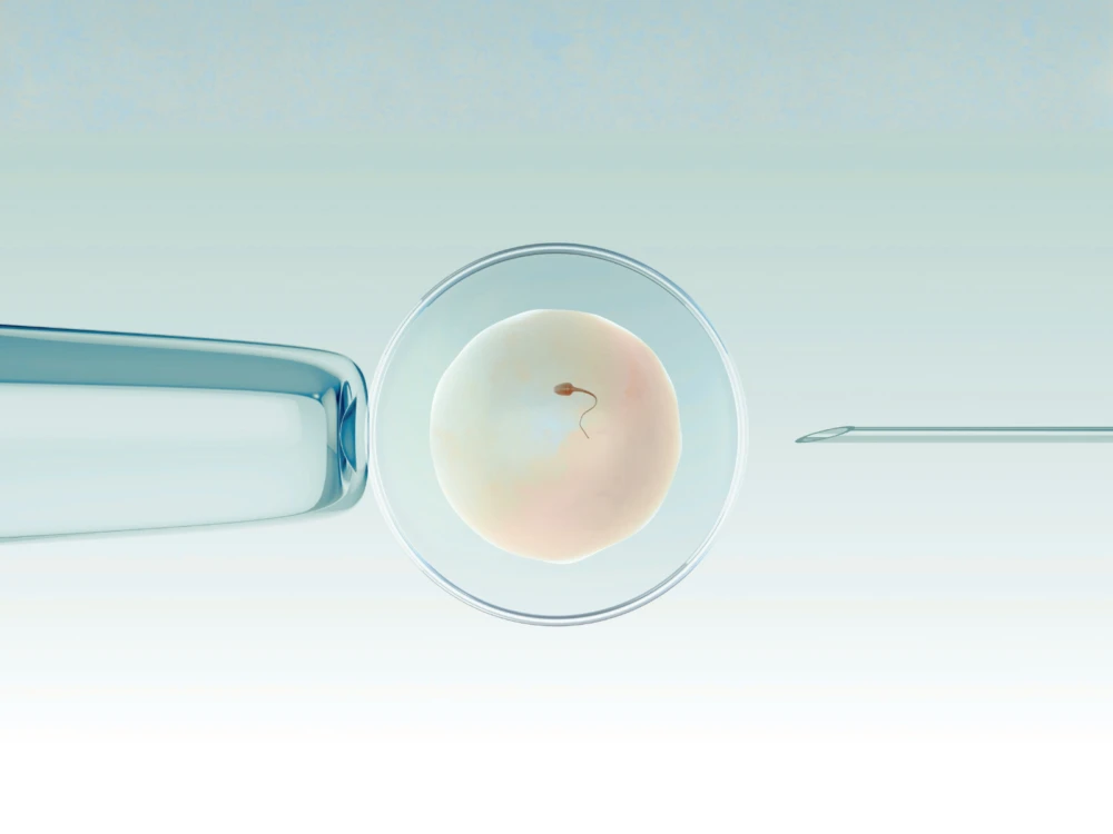 Sunfert IVF Intracytoplasmic Sperm Injection ICSI