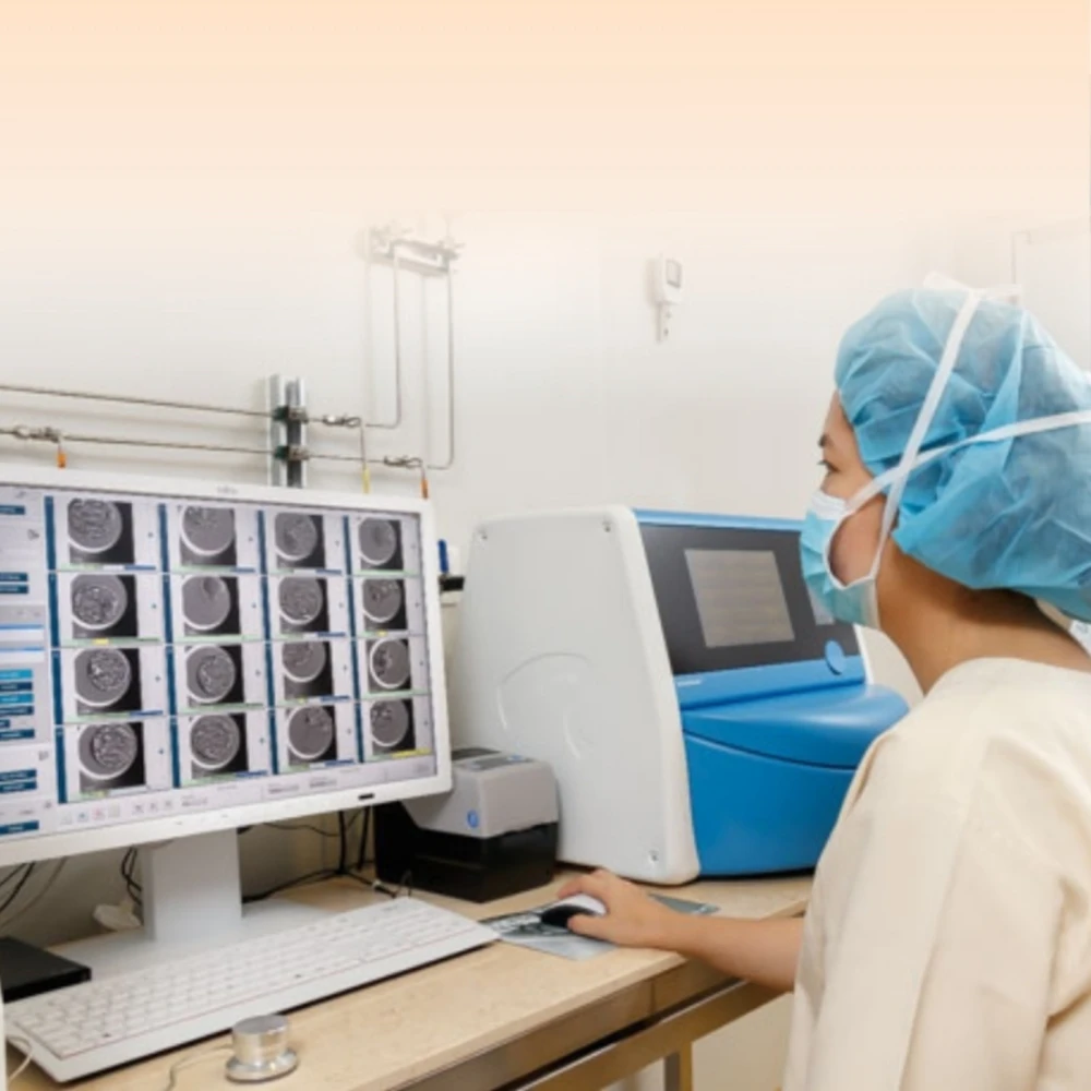 Sunfert IVF embryologist monitoring embryo development using EmbryoScope time lapse imaging for accurate assessment and selection