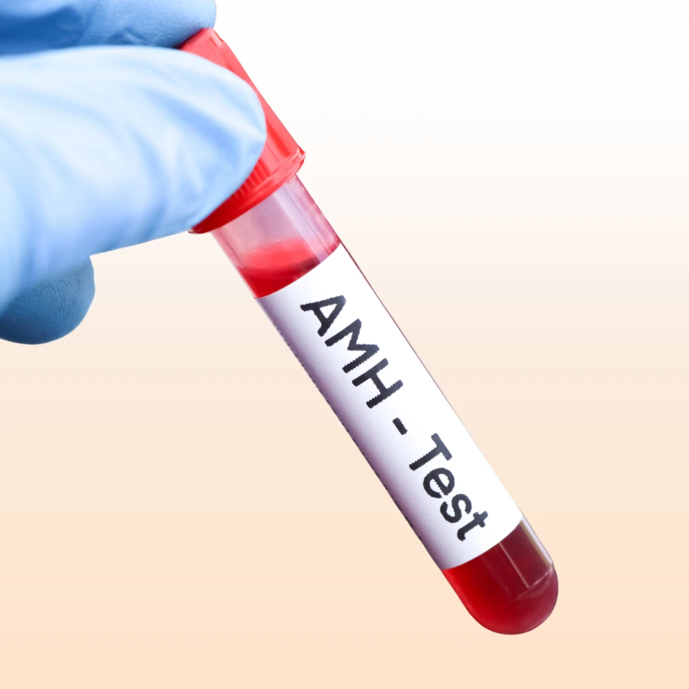 Understanding AMH levels and ovarian reserve for IVF fertility planning at Sunfert fertility centre