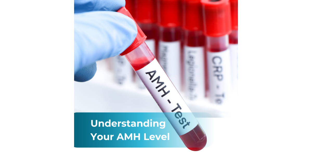 Sunfert • Anti-Mullerian Hormone (AMH) Test & Levels Explained