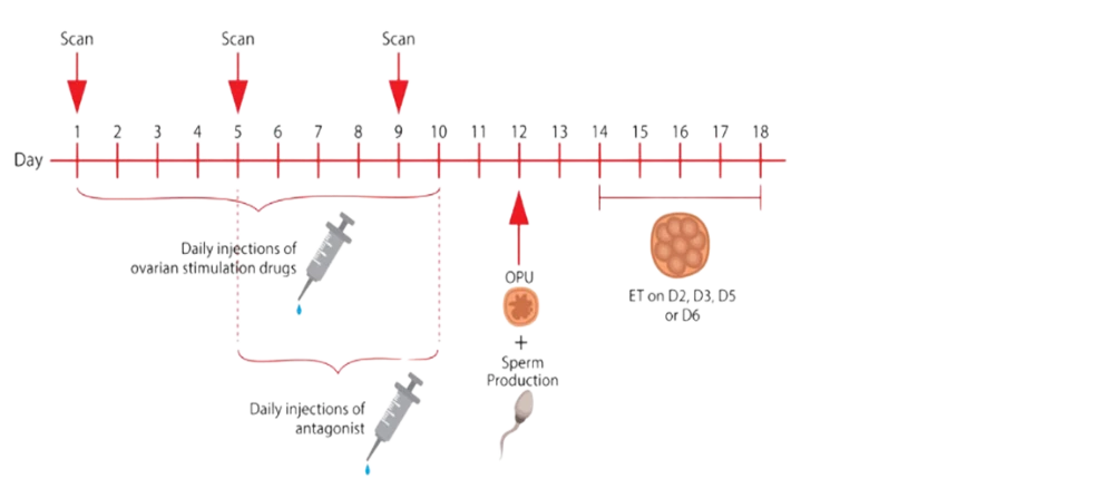Updated short gnrh protocol Transparent 2