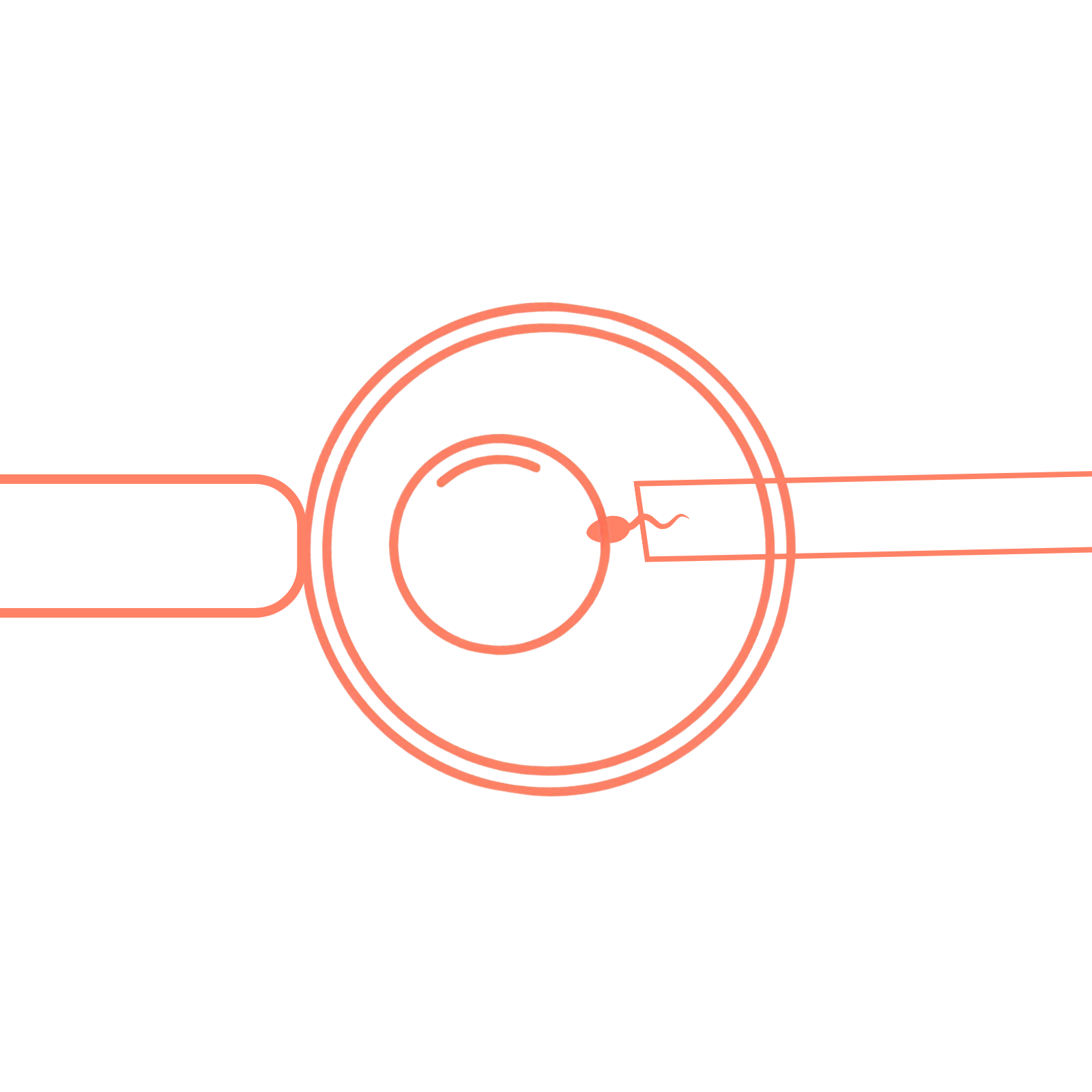 Sunfert intra-cytoplasmic sperm injection (ICSI) technique for targeted fertilisation