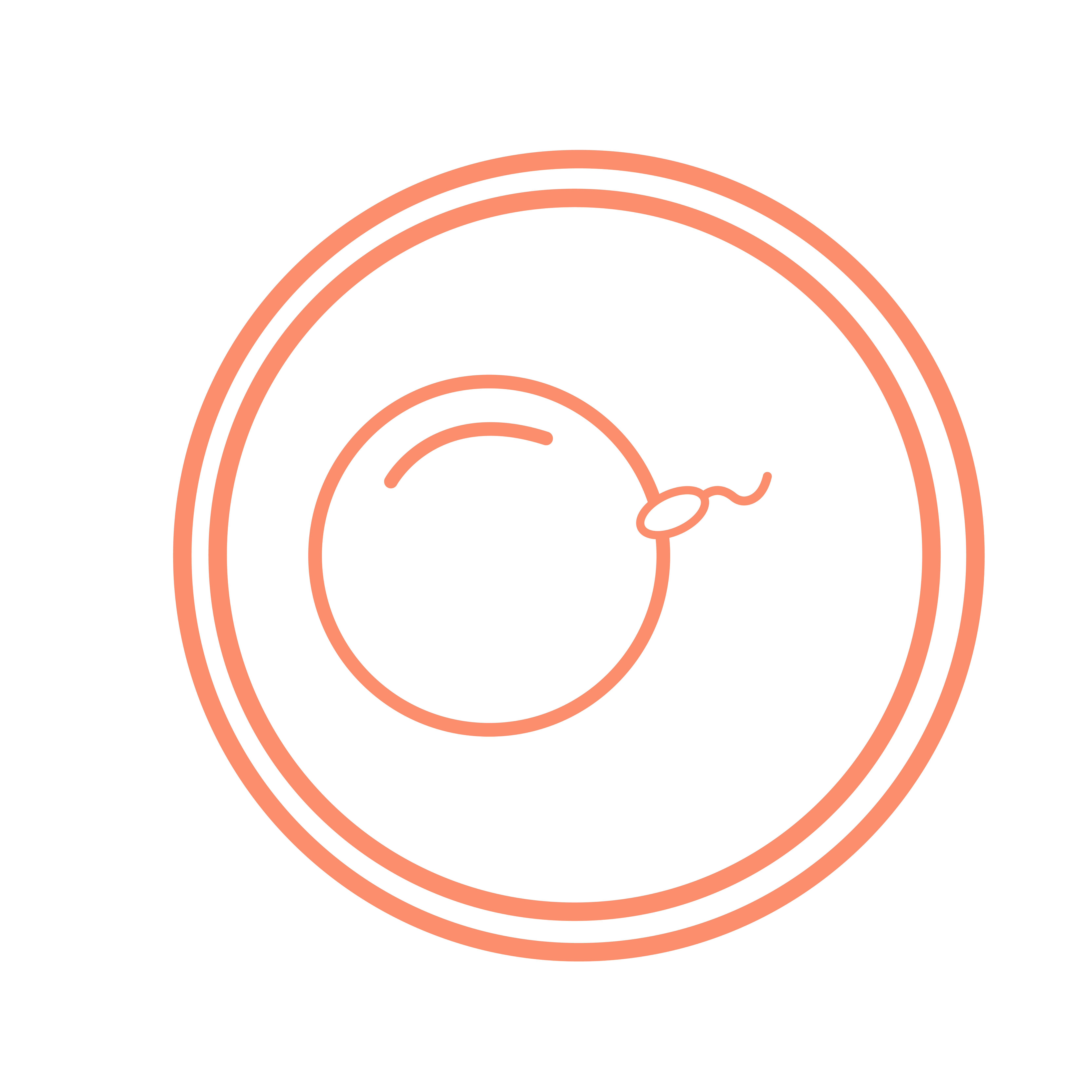 In-Vitro Fertilisation (IVF) treatment at Sunfert fertility centre for assisted reproduction