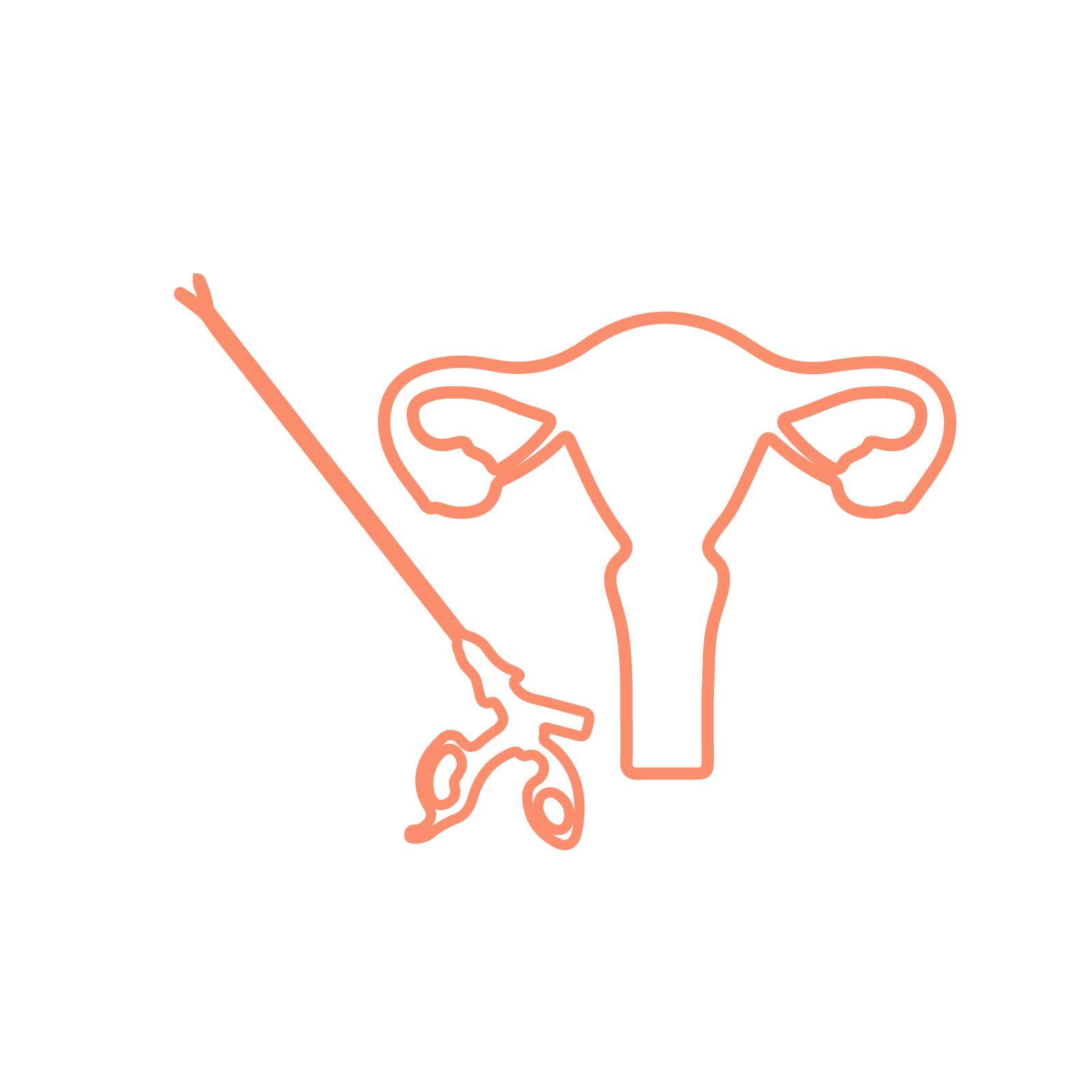 Reproductive surgery for female fertility treatment at Sunfert IVF centre