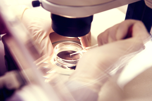 Embryo Selection/Genetic Screening