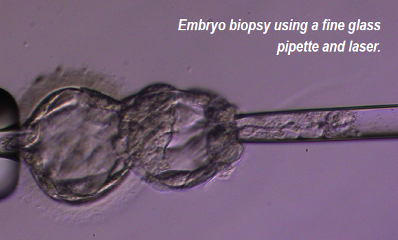 embryo biopsy pgt-a